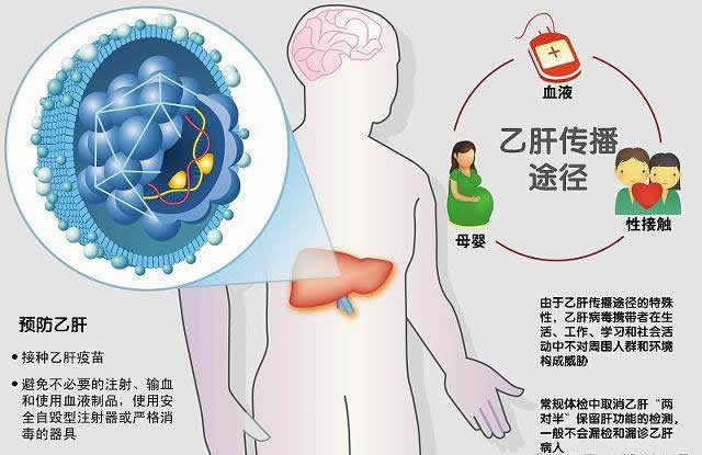 乙肝的預(yù)防措施是什么？