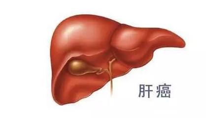 乙肝病人怎樣預(yù)防肝癌？